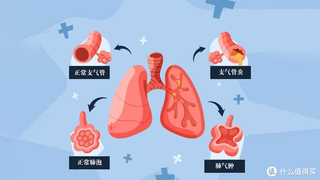 气管炎传染吗_传染性气管炎症状_气管炎传染病