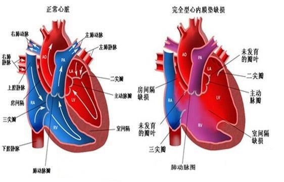 呼吸衰竭如何定义和分类_呼吸衰竭的定义和分型是什么_二型呼吸衰竭定义