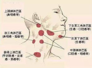 喉咙淋巴系统,喉咙淋巴系统的组成与功能解析