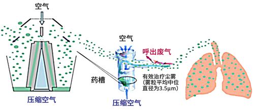 呼吸系统雾化药,呼吸系统疾病雾化药物应用与疗效分析